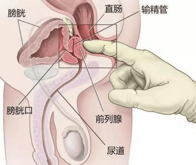 健康快报！保定治疗男科哪家医院好-睾丸胀痛与前列腺炎有关吗